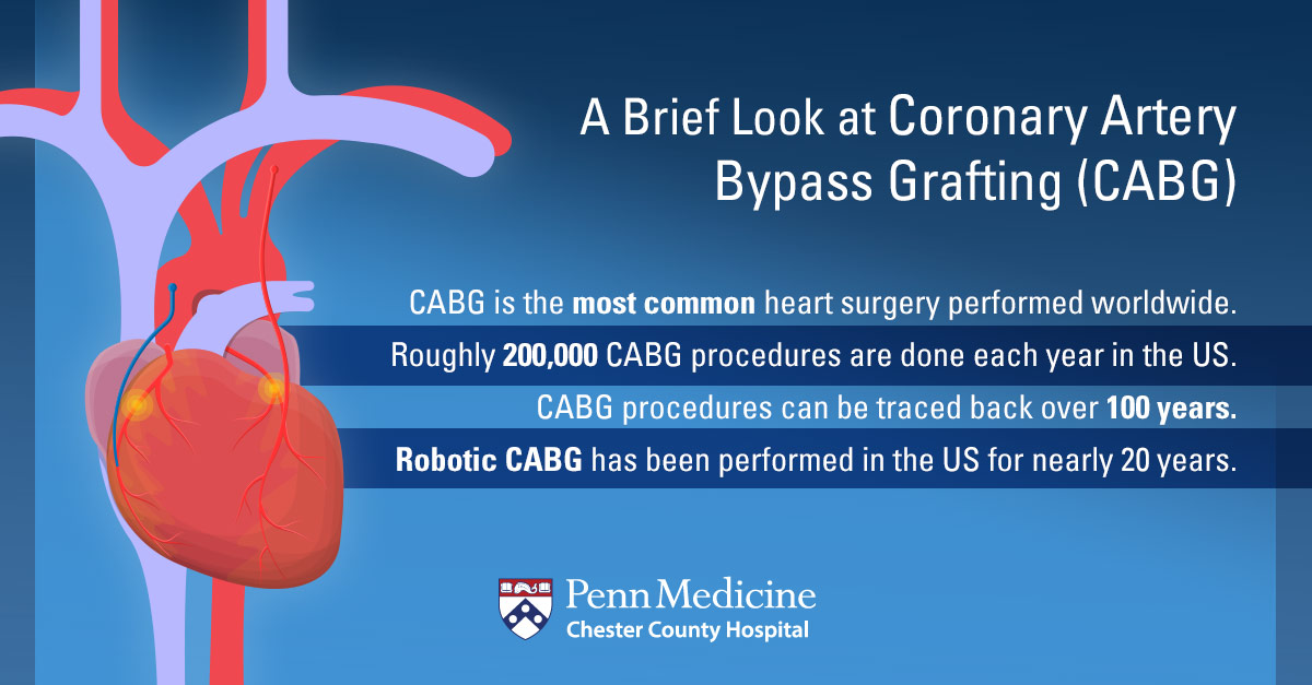 A Look At Robotic Coronary Artery Bypass Grafting Chester County Hospital Penn Medicine